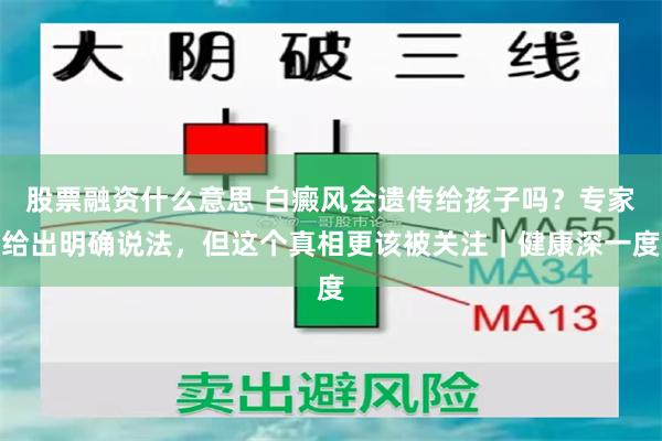 股票融资什么意思 白癜风会遗传给孩子吗?专家给出明确说法,但这个真相更该被关注|健康深一度